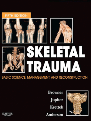 Skeletal Trauma: Basic Science, Management and Reconstruction