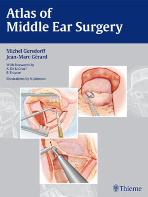 Atlas of Middle Ear Surgery by Gersdorff