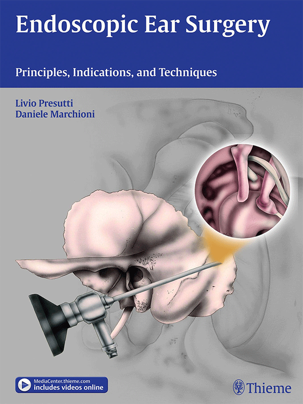 Endoscopic Ear Surgery: Principles, Indications and Techniques