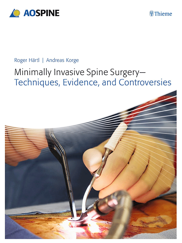 Minimally Invasive Spine Surgery: Techniques, Evidence and Controversies