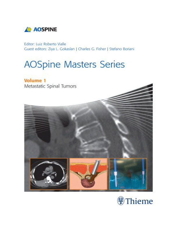 AOSpine Masters Series Volume 1: Metastatic Spinal Tumors