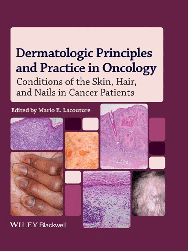 Dermatologic Principles and Practice in Oncology: Conditions of the Skin, Hair and Nails in Cancer Patients