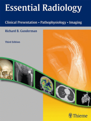 Essential Radiology: Clinical Presentation · Pathophysiology · Imaging