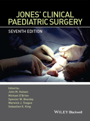 Jones' Clinical Paediatric Surgery
