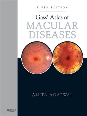 Gass Atlas of Macular Diseases