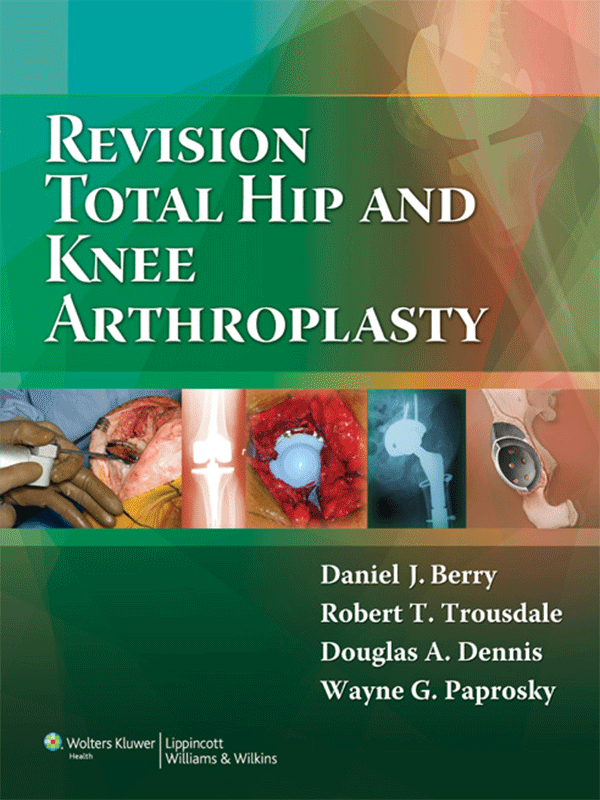 Revision Total Hip and Knee Arthroplasty