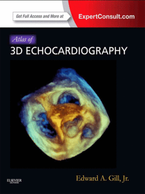 Atlas of 3D Echocardiography