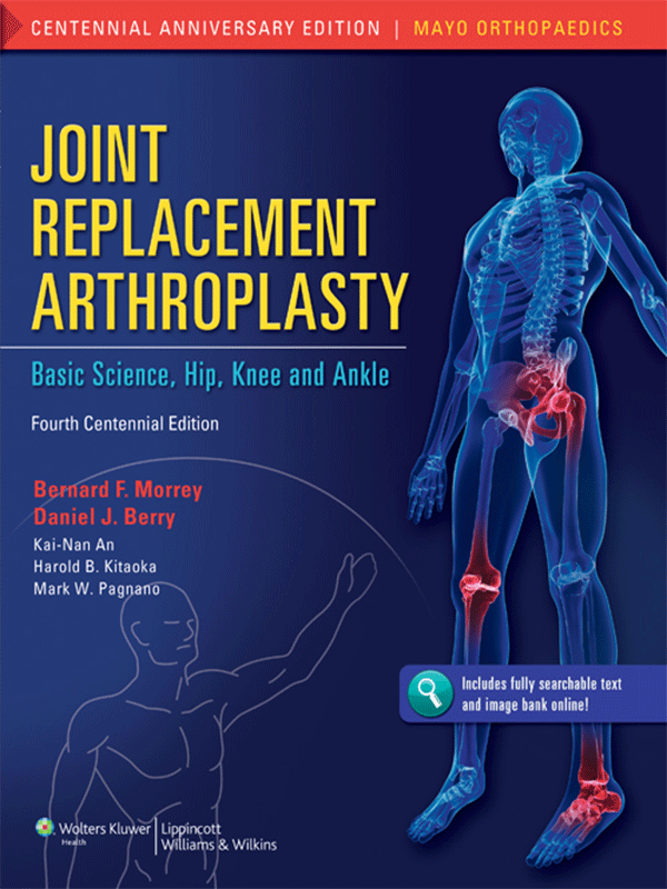 Joint Replacement Arthroplasty: Basic Science, Hip, Knee and Ankle