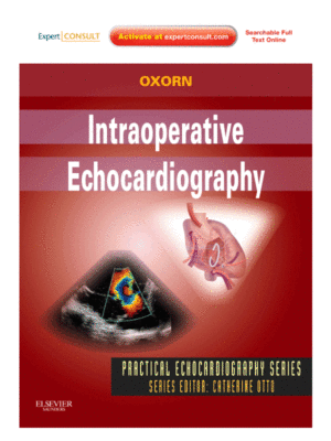 Intraoperative Echocardiography