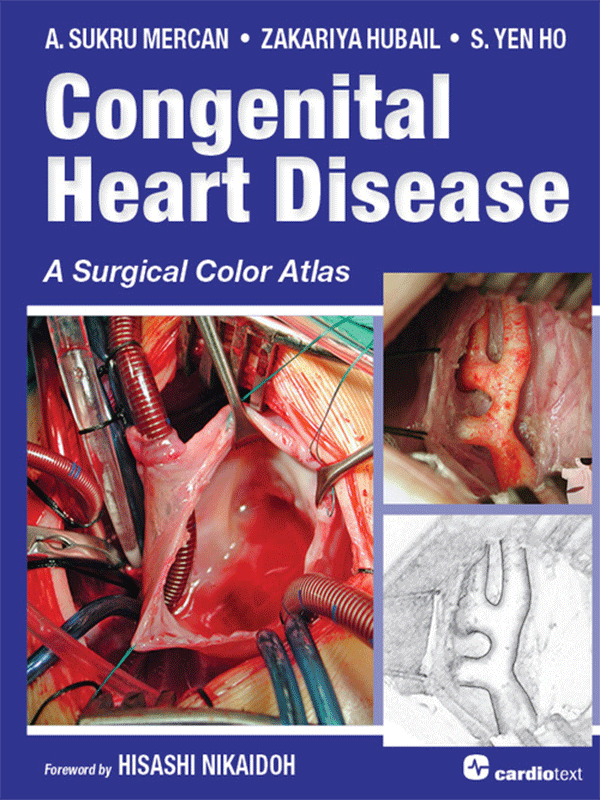 Congenital Heart Disease: A Surgical Color Atlas