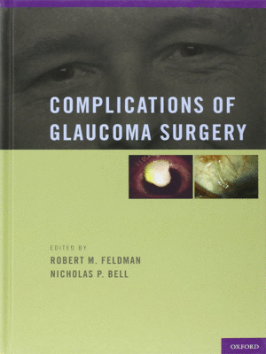 Complications of Glaucoma Surgery