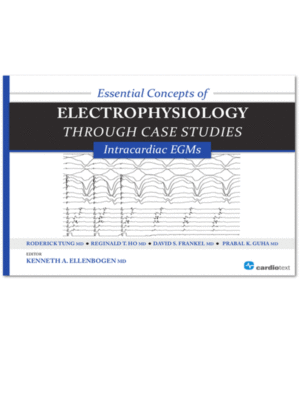 Essential Concepts of Electrophysiology through Case Studies: Intracardiac EGMs