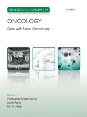 Challenging Concepts in Oncology