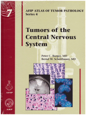 AFIP Atlas of Tumor Pathology: Tumors of the Central Nervous System