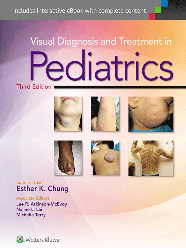 Visual Diagnosis and Treatment in Pediatrics, 3rd Edition