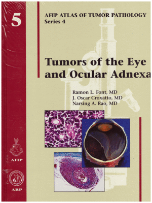 AFIP Atlas of Tumor Pathology: Tumors of the Eye and Ocular Adnexa