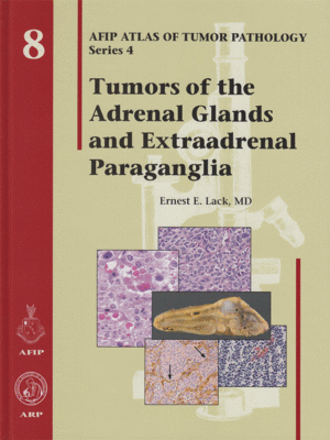 AFIP Atlas of Tumor Pathology: Tumors of the Adrenal Glands and Extraadrenal Paraganglia