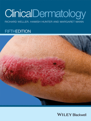 Clinical Dermatology