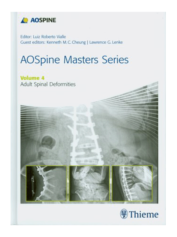 AOSpine Masters Series, Volume 4: Adult Spinal Deformities