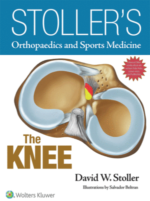 Stoller's Orthopaedics and Sports Medicine: The Knee