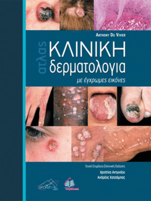 Άτλας Κλινικής Δερματολογίας