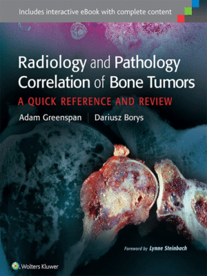 Radiology and Pathology Correlation of Bone Tumors: A Quick Reference and Review