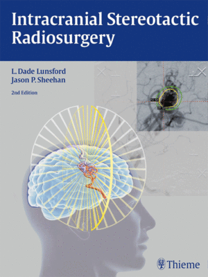 Intracranial Stereotactic Radiosurgery