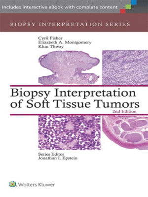 Biopsy Interpretation of Soft Tissue Tumors