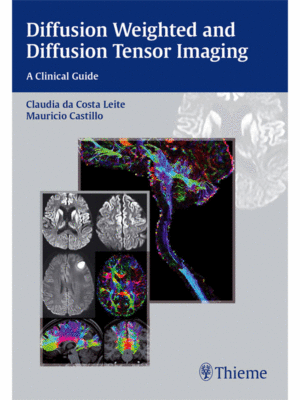Diffusion Weighted and Diffusion Tensor Imaging