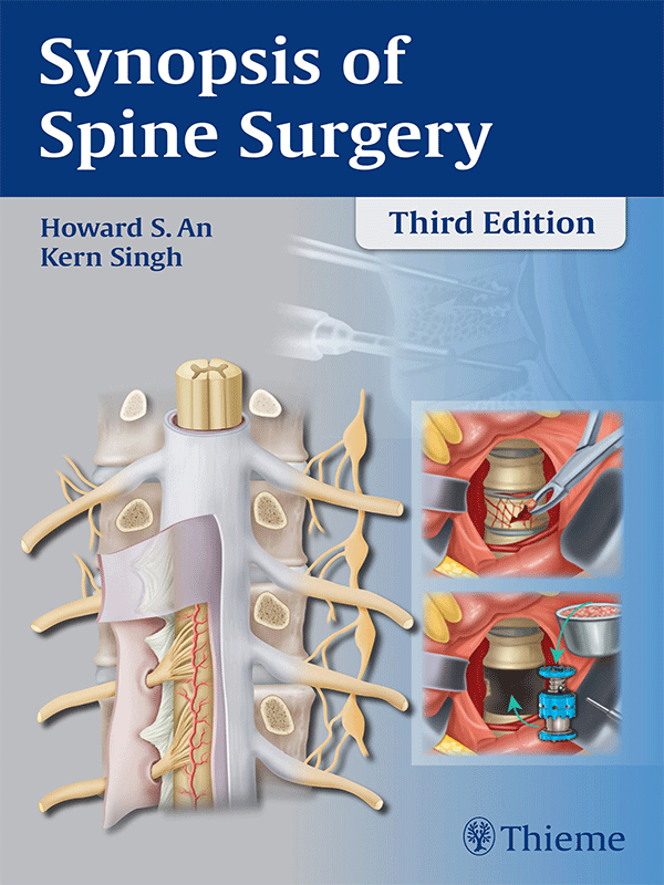 Synopsis of Spine Surgery