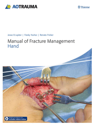 Manual of Fracture Management: Hand