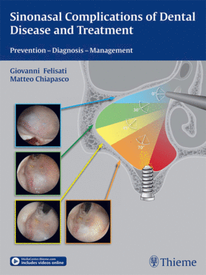 Sinonasal Complications of Dental Disease and Treatment: Prevention - Diagnosis - Management