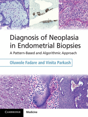 ¨Diagnosis of Neoplasia in Endometrial Biopsies: A Pattern-Based and Algorithmic Approach