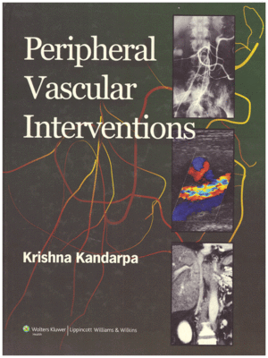 Peripheral Vascular Interventions