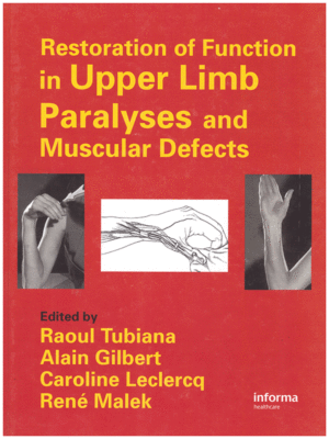 Restoration of Function in Upper Limb Paralyses and Muscular Defects
