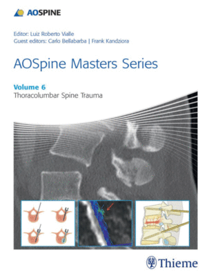 AOSpine Masters Series, Volume 6: Thoracolumbar Spine Trauma