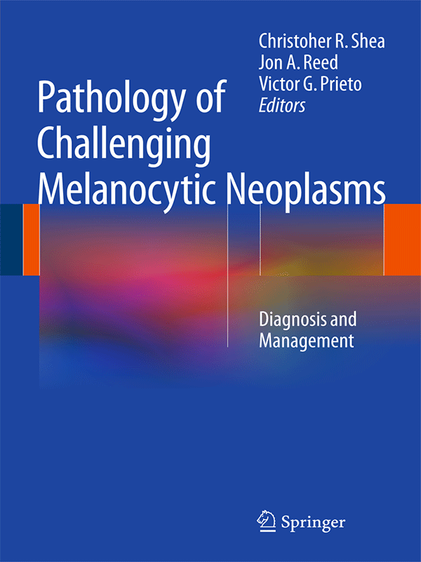 Pathology of Challenging Melanocytic Neoplasms: Diagnosis and Management
