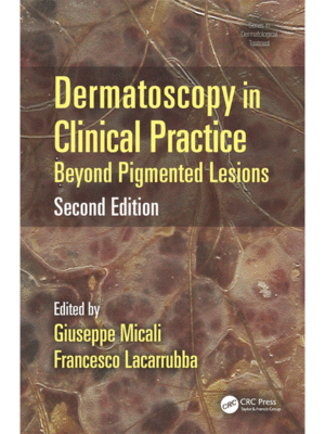 Dermatoscopy in Clinical Practice