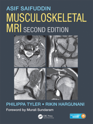 Musculoskeletal MRI by Tyler