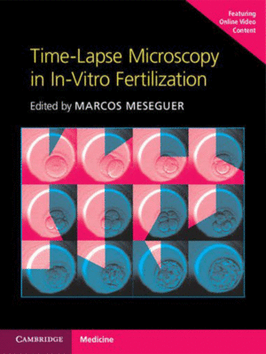 Time-Lapse Microscopy in In-Vitro Fertilization