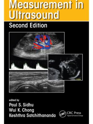 Measurement in Ultrasound