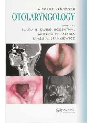 Otolaryngology: A Color Handbook
