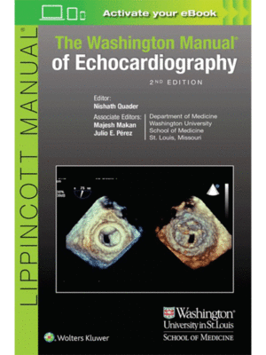 The Washington Manual of Echocardiography