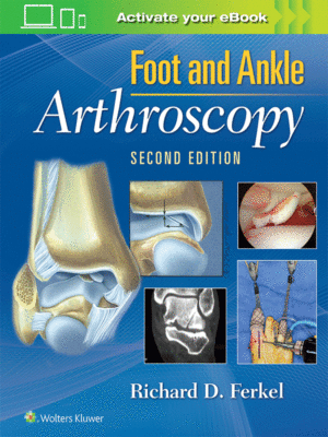 Foot & Ankle Arthroscopy
