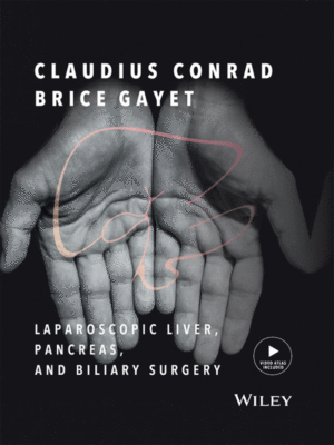 Laparoscopic Liver, Pancreas and Biliary Surgery