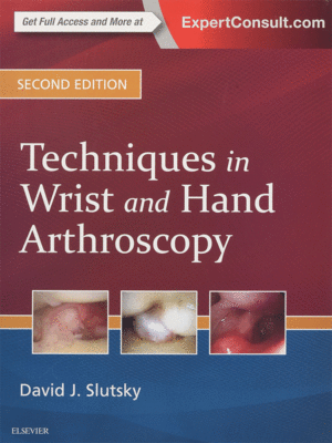 Techniques in Wrist and Hand Arthroscopy by Slutsky, 2nd Edition