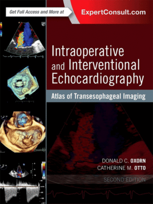 Intraoperative and Interventional Echocardiography by Oxorn & Otto: Atlas of Transesophageal Imaging, 2nd Edition