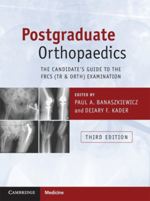 Postgraduate Orthopaedics: The Candidate's Guide to the FRCS (Tr & Orth) Examination