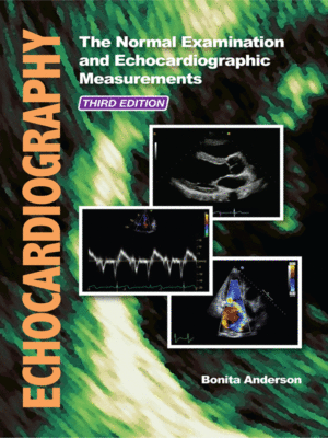 Echocardiography by Bonita Anderson