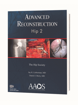 Advanced Reconstruction: Hip 2